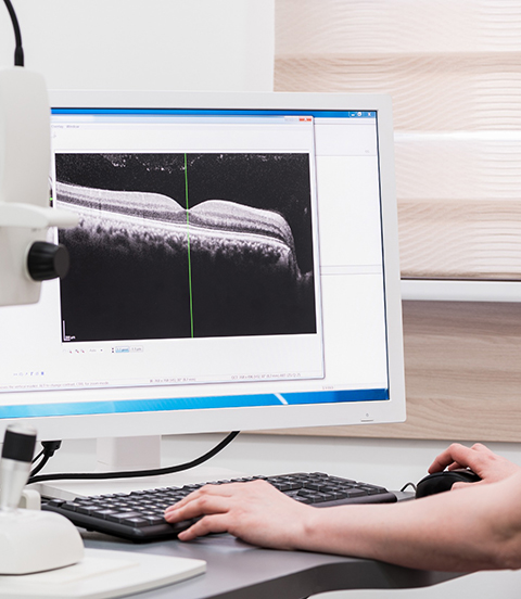 Enrica Gori esame OCT